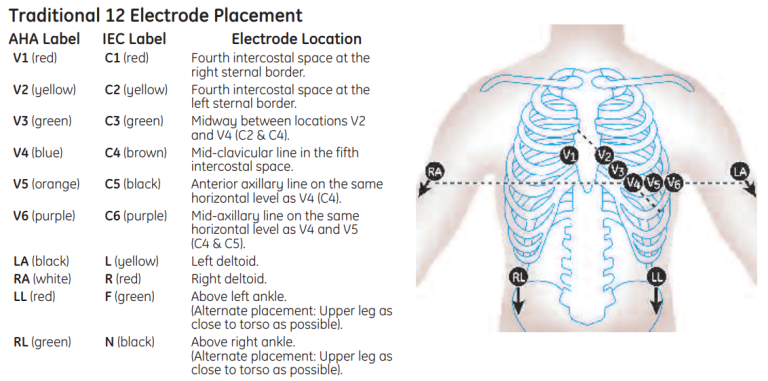 diagnostic-ecg-lead-placement-clinical-view